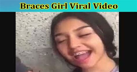 braces girl leaked|[Full Original Video] Braces Girl Viral Video: Check The Content。